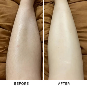 before_after_1_1.webp