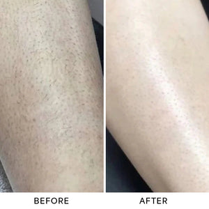before_after_3_2.webp